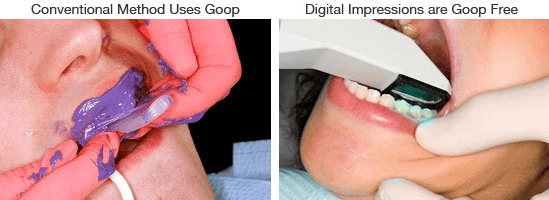 With and Without Goop